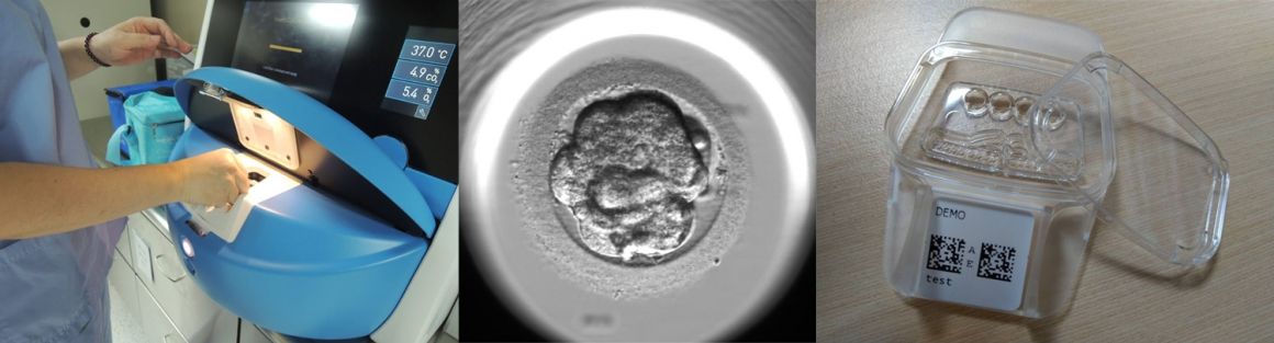 哪些遗传病可以通过第三代试管婴儿进行筛查？
